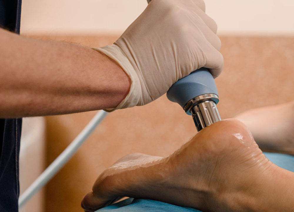 Shockwave Therapy at The Physiosports Group