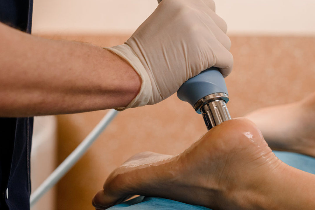 Shockwave Therapy at The Physiosports Group